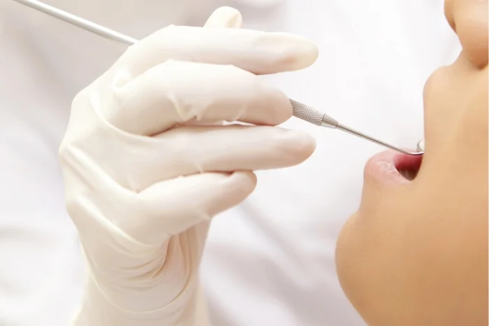 歯ぐきが腫れている・血が出る